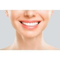 60-Minute Laser Teeth Whitening Session At Haus Of Skin - On-Site Treatment In Stoke-On-Trent
