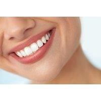 Teeth Whitening - Exeter, Pebble Brook Clinic