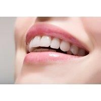 Laser Teeth Whitening Session With Top Up & Aftercare At Migas Beauty Lab, Birmingham